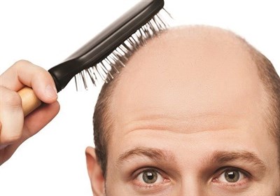  "ریزش مو" از عوارض کرونا/ ریزش چند تار مو در طول روز طبیعی است؟! 