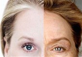 aging cells