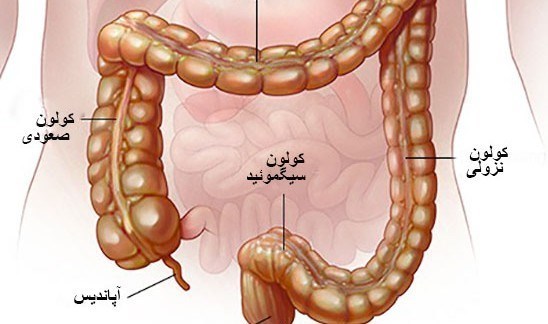 عکس کولیت روده