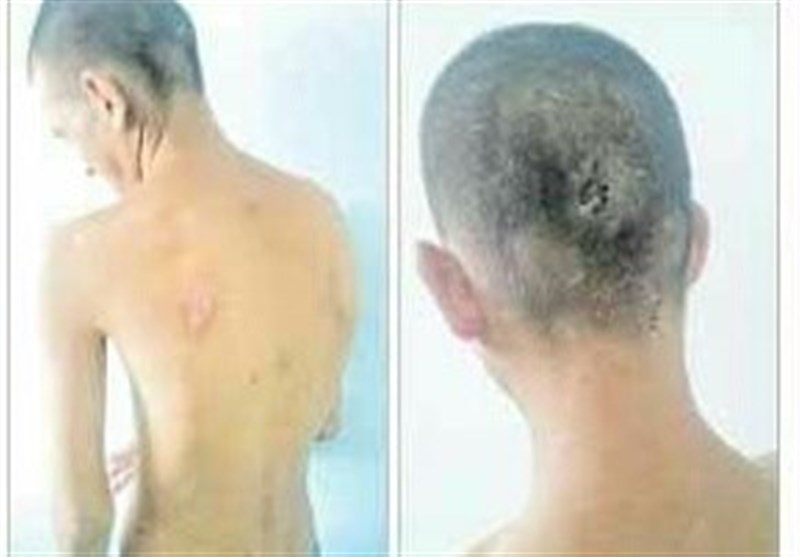 ضرب و شتم معلول ذهنی در مرکز توانبخشی یاسوج در حد یک ادعا است