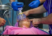 رکورد جهانی عمل جراحی شکاف لب در لرستان شکست