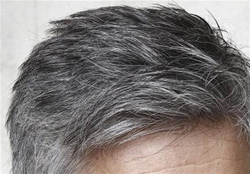 اینفوگرافی| عوامل مؤثر در سفیدی زودرس مو