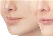 7 راهکار ساده طب سنتی برای «پُر شدن صورت»