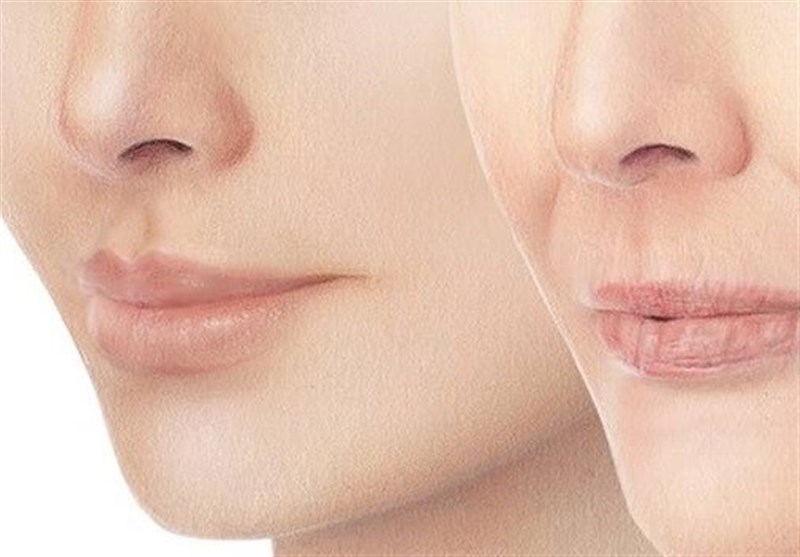 7 راهکار ساده طب سنتی برای «پُر شدن صورت»