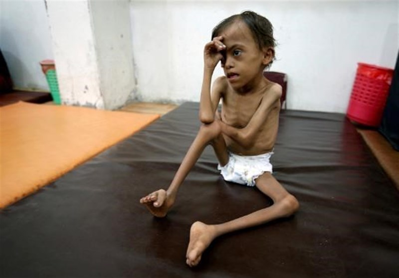 هشدار بهداشت جهانی درباره احتمال مرگ 150 هزار کودک یمنی/ درخواست گوترش برای بازگشایی فوری گذرگاه‌های یمن