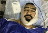 آخرین وضعیت &quot;طلبه‌ تهرانی&quot; که با ضربات قمه یک اوباش مجروح شد + تصاویر