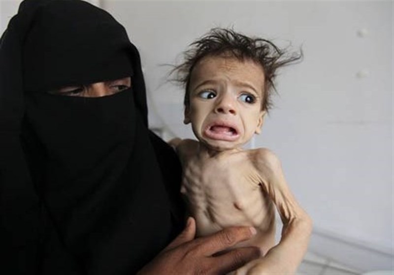 یمن میں 8 میلین افراد شدید قحط کا شکار، قوام متحدہ