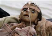 نگاهی به کابوس قحطی و بدبختی و گرسنگی در یمن