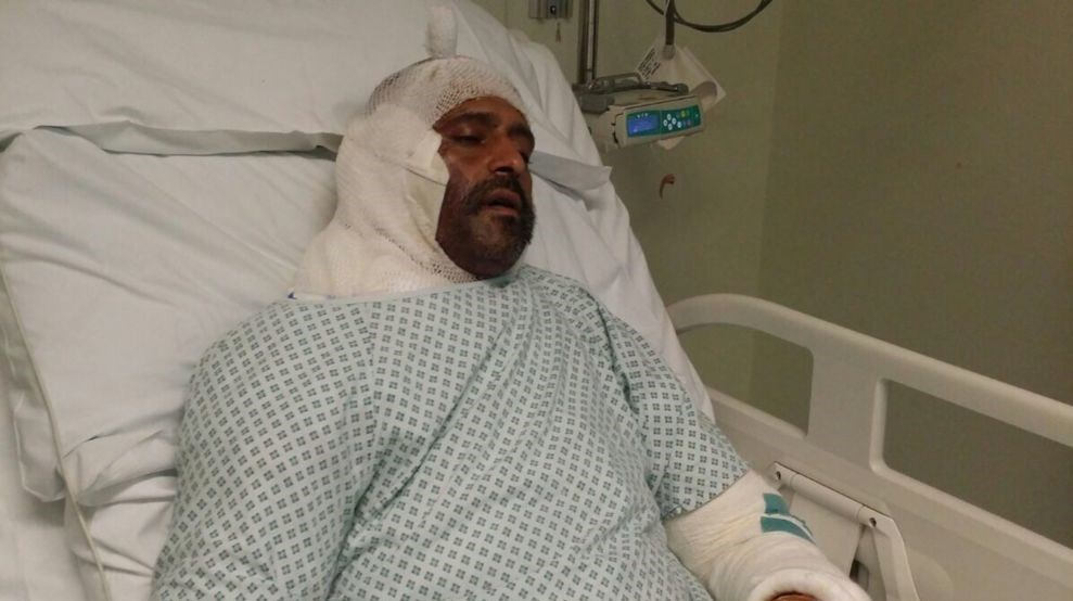 درددل‌های یک قربانی اسیدپاشی در لندن+تصاویر