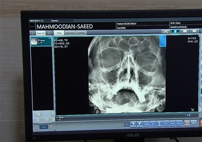 Researchers Chart A New Way to Look at Concussion