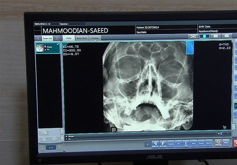 Researchers Chart A New Way to Look at Concussion