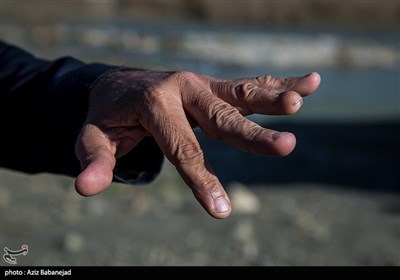  بیش از 20 نفر از اهالی این روستا انگشتانشان بر اثر استفاده از "گرگر" قطع شده است