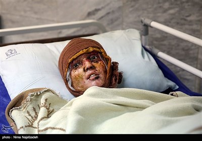 مجروحان حادثه تروریستی کابل- مشهد