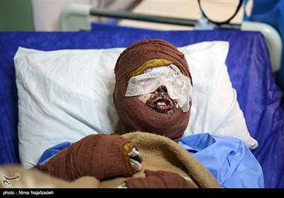  مجروحان حادثه تروریستی کابل- مشهد