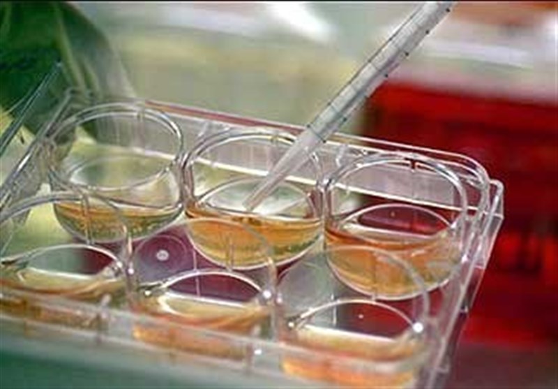 بوشهر| 90 هزار نمونه خون بند ناف در بانک سلول‌های بنیادین ذخیره سازی شد