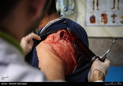  مصدومان چهارشنبه آخر سال در بیمارستان 15 خرداد 