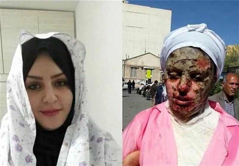 دادستان تبریز: تحقیقات پرونده اسیدپاشی اخیر تکمیل شده است