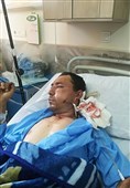 گرگان| حال مرد آسیبدیده در پی حمله پلنگ در کلاله مساعد است