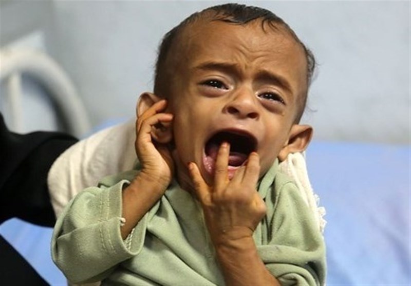 اوضاع فاجعه بار یمن به روایت صندوق نجات کودکان