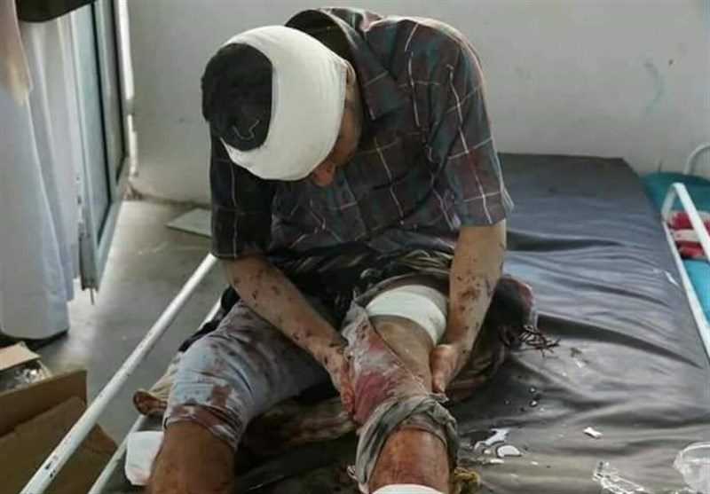 صنعا میں تیل کی کمپنی پر سعودی حملے میں 16 یمنی مسلمان شہید یا زخمی + ویڈیو اور تصاویر