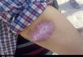 ریشه‌کنی و پیشگیری بیماری سالک در دستور کار کمیته محرومیت‌زدایی شورای شیراز