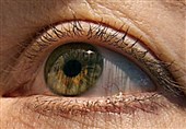 Predicting Alzheimer's Disease May Be Possible Using Eye Exam