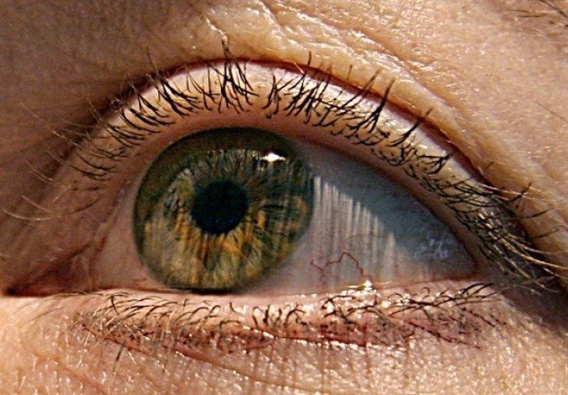 Predicting Alzheimer&apos;s Disease May Be Possible Using Eye Exam