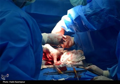  چله عزت|ماجرایی ترسناک عمل جراحی در اردوگاه عنبر 