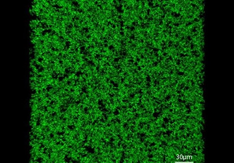 Biomaterial Artificial Protein Helps Heal Tissue