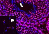 Nicotine Use of Father Can Cause Cognitive Problems in Children