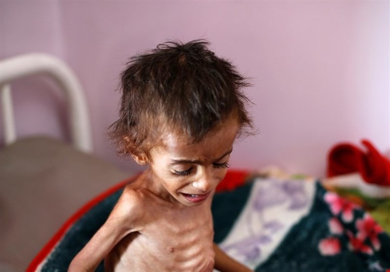 سعودی جارحیت: یمن میں 18لاکھ بچوں کو خوراک میسرنہیں، اقوام متحدہ