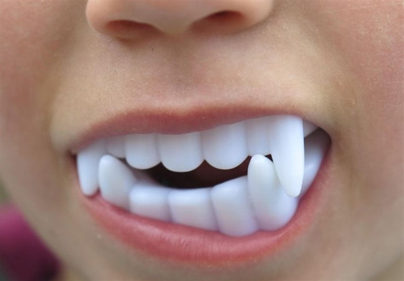 دندان شیشه‌ای دراکولا، کودک 5 ساله را روانه بیمارستان کرد