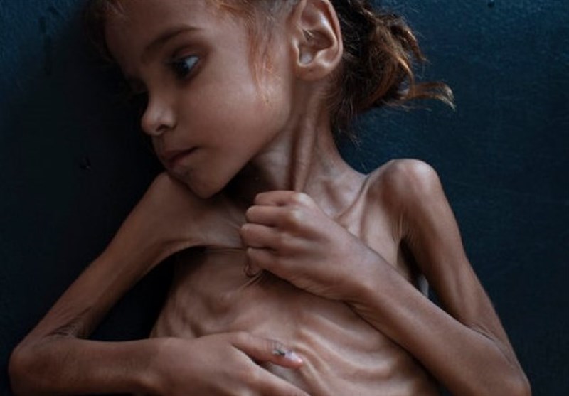 UNICEF: Yemen Çocukların Cehennemi Oldu / Her 10 Dakikada Bir Çocuk Ölüyor