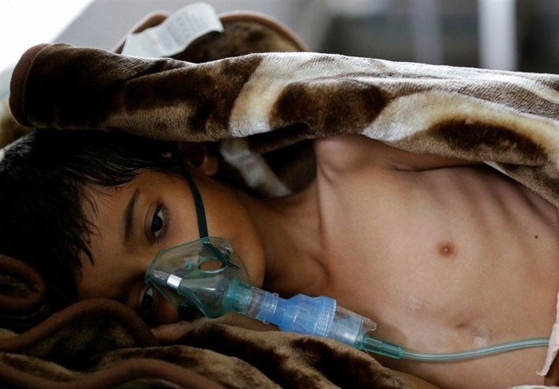 سازمان ملل| هر 12 دقیقه یک کودک زیر 5 سال در یمن می‌میرد