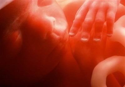  دیه "جنین سقط‌شده صاحب روح" ۴۸۰میلیون تومان!+ جزئیات 