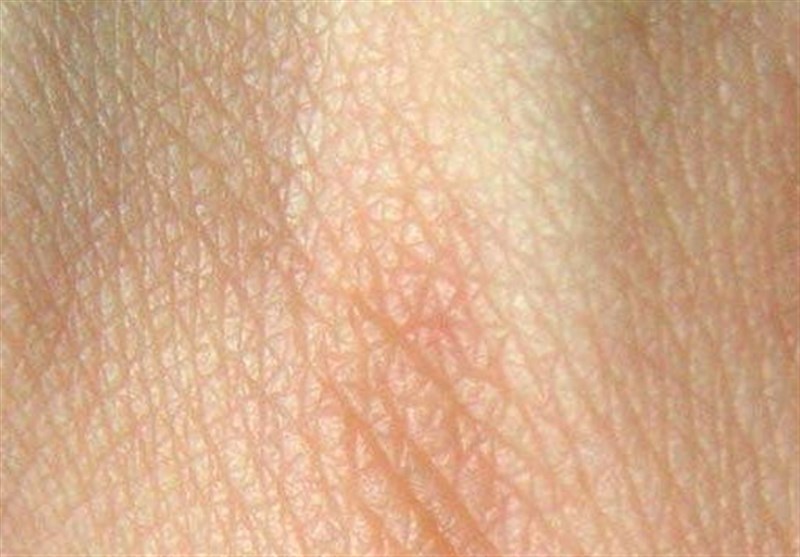 Researchers Regrow Hair Strands on Damaged Skin