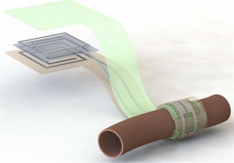 New Biodegradable Blood Flow Sensor Can Impact Multiple Blood-Related Fields