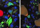 Researchers Stop Breast Cancer Cells from Spreading by Turning them into Fat