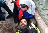 پلیس فرانسه معترض جلیقه‌زرد را نابینا کرد+فیلم