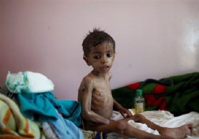  هشدار سازمان ملل درباره خطر قحطی مجدد در یمن 