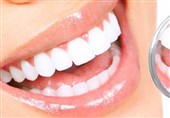 دانتوں کی پیلاہٹ بھول جائیں ، چند منٹوں میں دانتوں کو سفید چمکتے موتی بنائیں