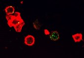 Immune Stimulant Molecule Protects against Cancer Development: Researchers Discover