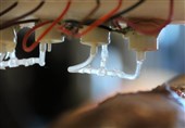 Mobile Bioprinter Speeds Up Healing Process by Printing Skin