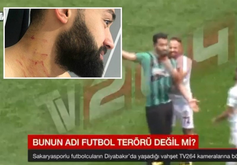 Turkish Football Player Attacks Opponent with Razor Blade in Shocking Video