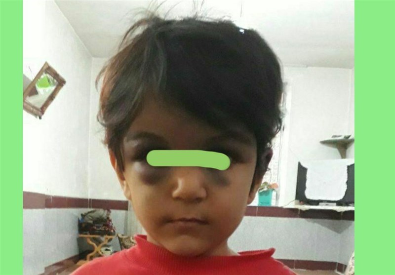ارومیه|صدور حکم جلب نامادری کودک آزار/ستایش از بیمارستان مرخص شد