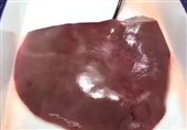 Bio-Glue Can Heal Fatal Wounds to Organs