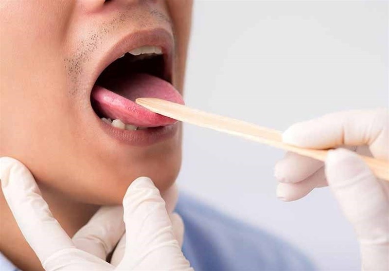 سرطان زبان چه نشانه‌هایی دارد؟
