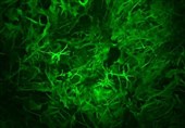 Brain&apos;s Astrocytes Have Leading Role in Establishing Long-Term Memory