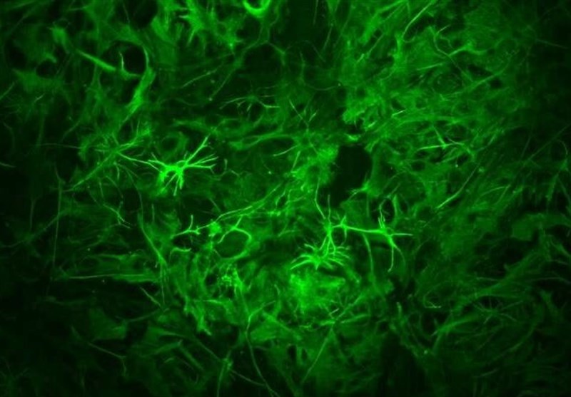 Brain&apos;s Astrocytes Have Leading Role in Establishing Long-Term Memory