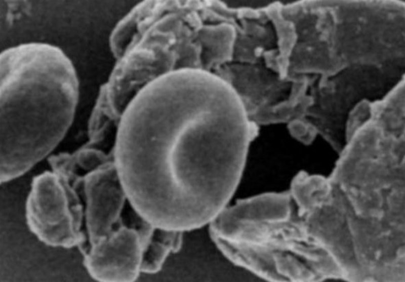 Bone-Like Particles Found Travelling through Human Bloodstream